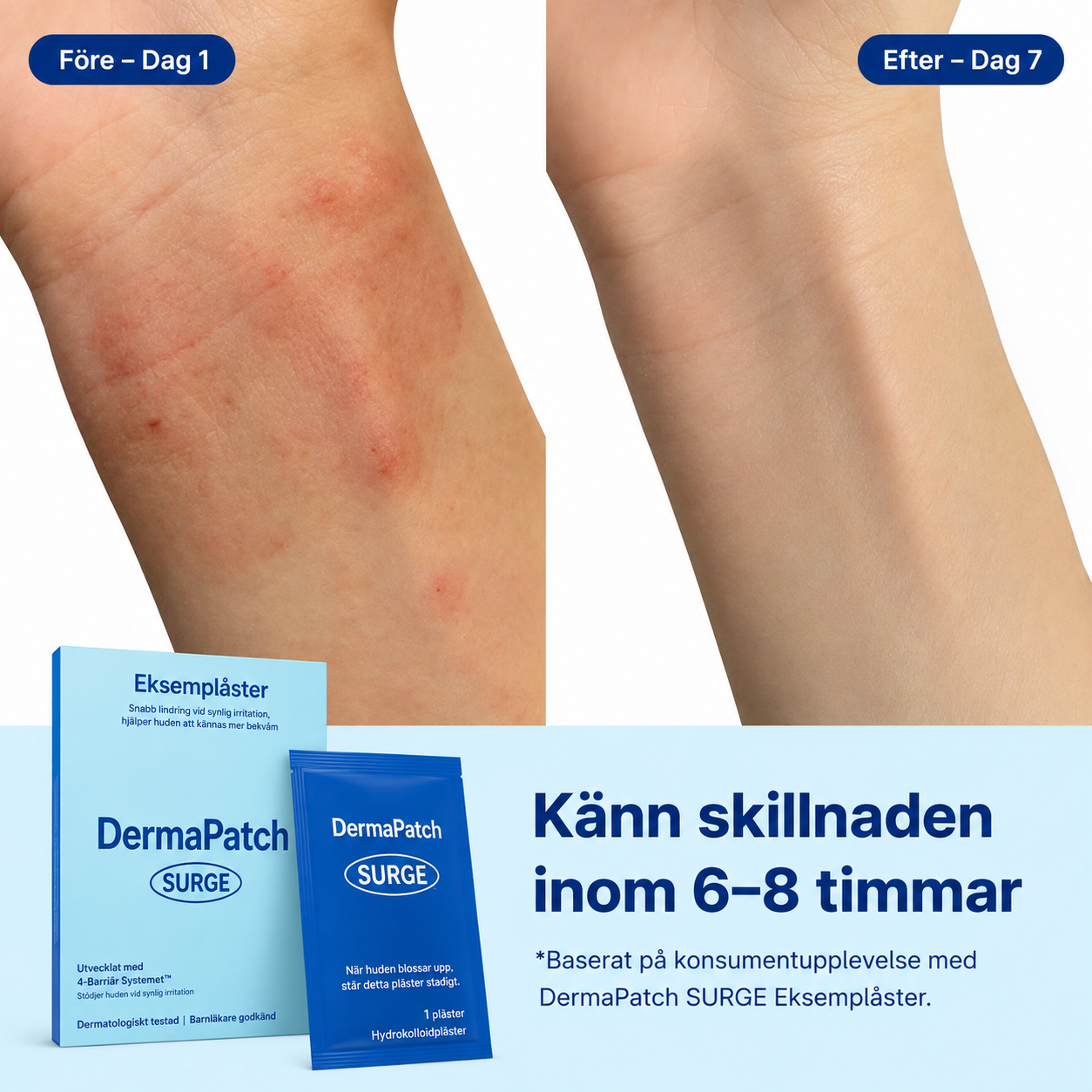 DermaPatch™ Eksemplåster