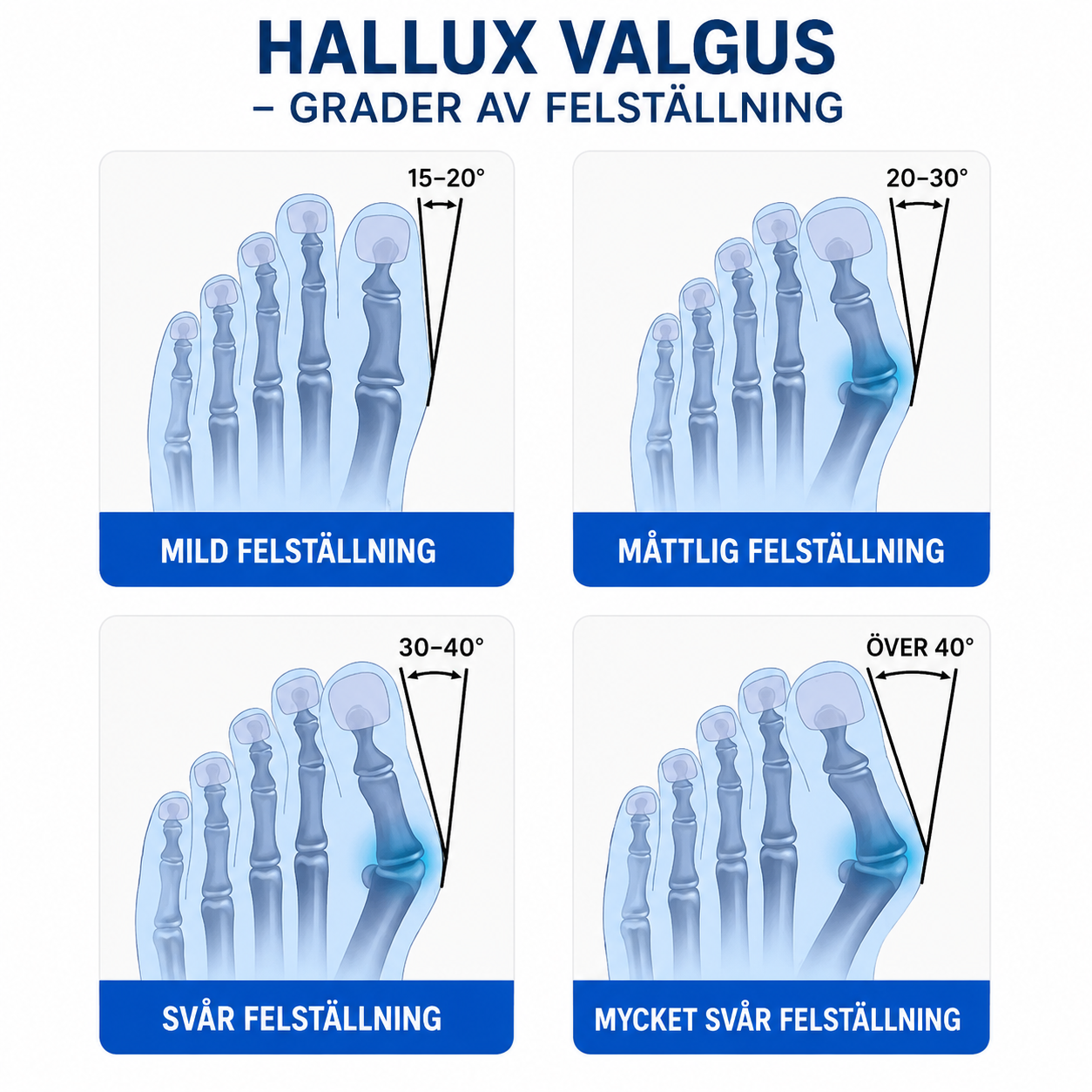 HalluxCare™ Tå- & Fotstöd