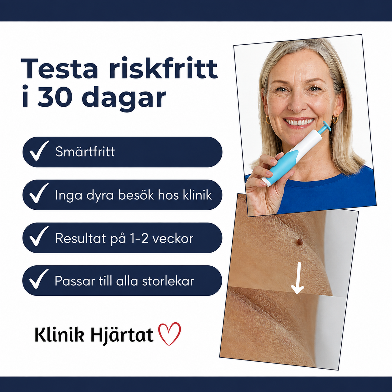 Hudfliksborttagare