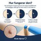 Hudfliksborttagare